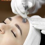 Acne Mesotherapy Penang
