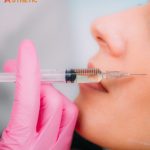 Cheek Fat Reduction Penang