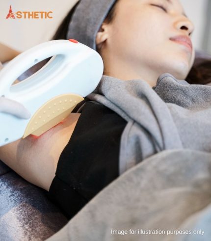 Laser Hair Removal Penang