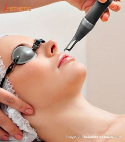 Lip Laser Treatment Penang