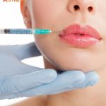 Lip Reshaping Penang