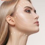 Non-Surgical Lifting Penang