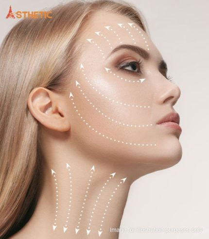 Non-Surgical Lifting Penang