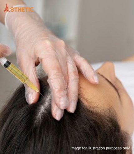 PRP Hair Treatment Penang