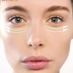 Tear Trough Filler Penang