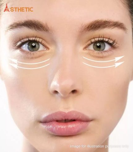 Tear Trough Filler Penang